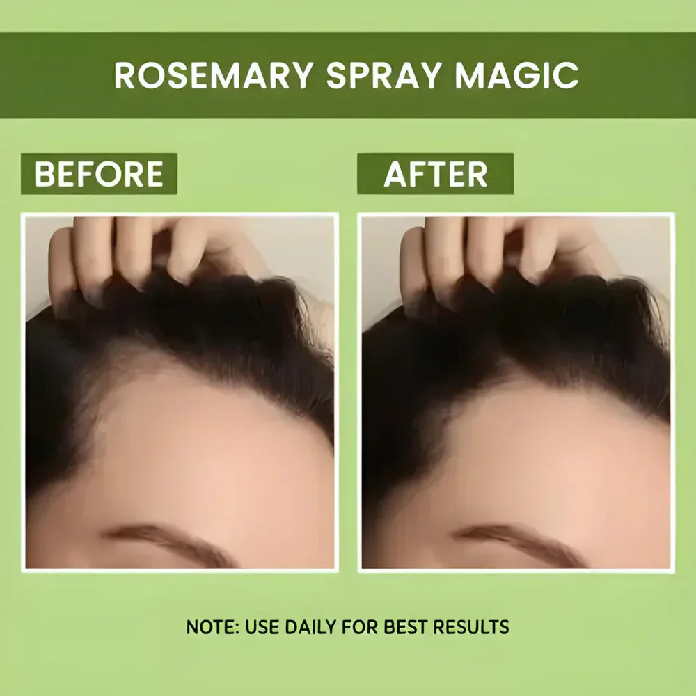 Rosemary Water Spray | For Hair Regrowth (Buy 1 Get 2 Free 馃槏)