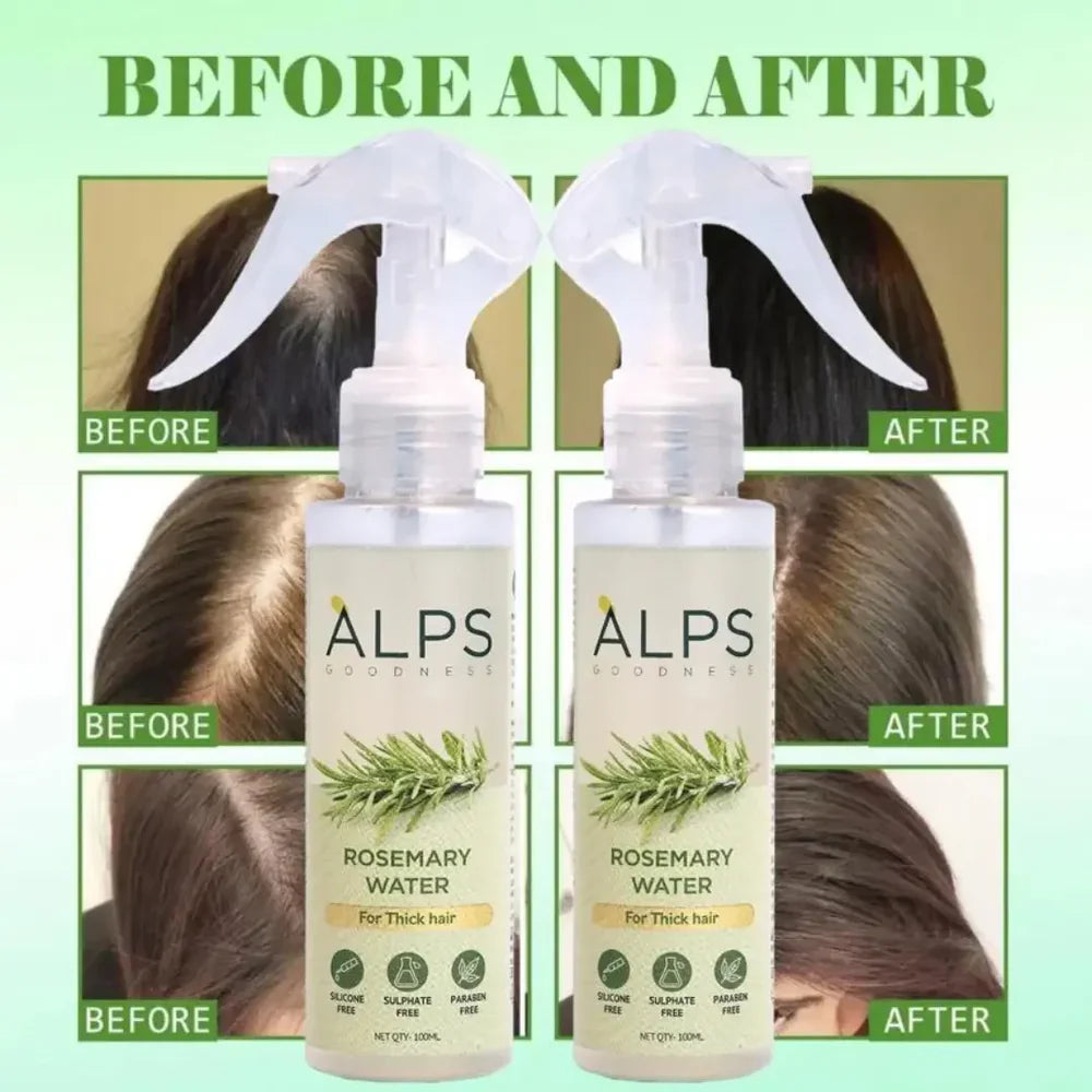 Rosemary Water Spray | For Hair Regrowth (Buy 1 Get 2 Free 馃槏)